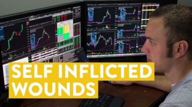 [LIVE] Day Trading | Self Inflicted Wounds… (idiot!)